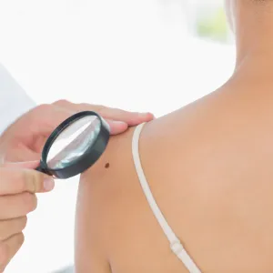 physician performing skin check on patient