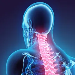 spinal_fusion