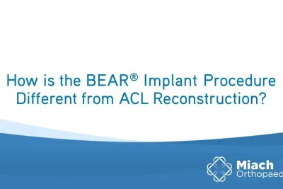 How is the BEAR Implant Procedure Different from ACLR? | Q&A | Dr. Sean Keyes | Miach Orthopaedics