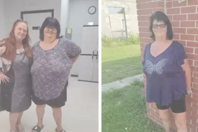 "Weight Loss Surgery Saved My Life" - Sam