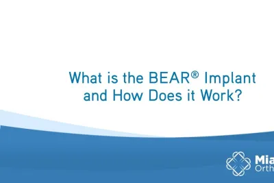 What is the BEAR Implant and How Does it Work? | Q&A | Dr. Sean Keyes | Miach Orthopaedics