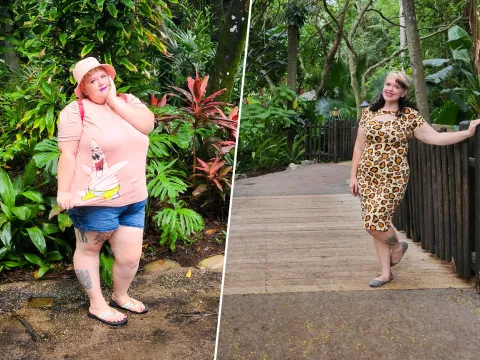 Meagan Before and After surgery