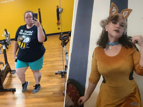 Meagan Before and After surgery