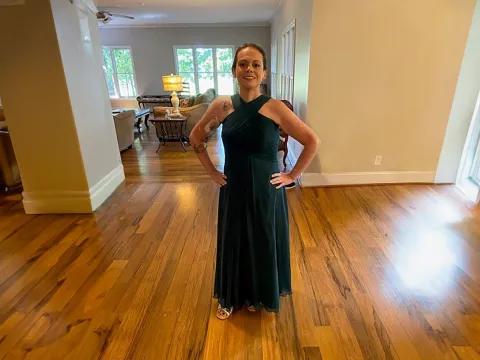 Caitlyn Dobbs After Bariatric Surgery