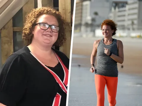 Chelsea Before and After Bariatrics