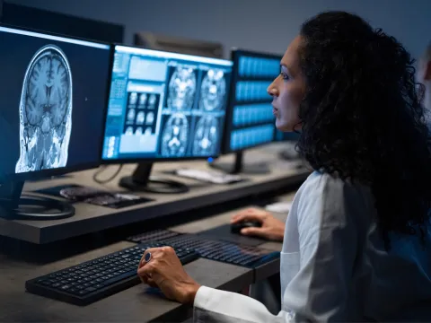 Doctor looking at a brain CT scan.