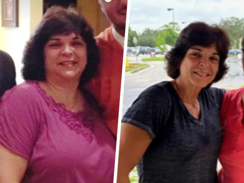 Ellen Before and After Bariatrics