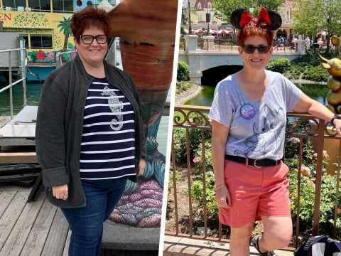 Sarah Before and After Bariatrics