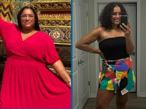 Sharlene Before and After