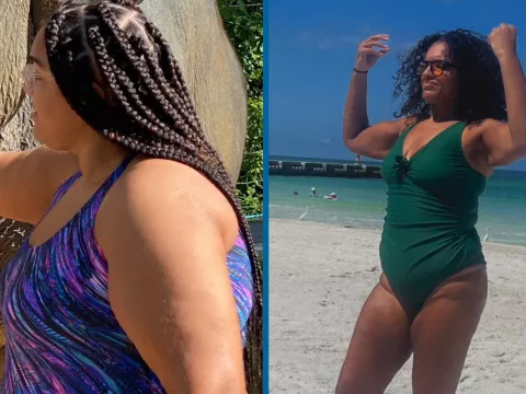 Sharlene Before and After 