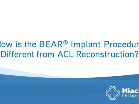 How is the BEAR Implant Procedure Different from ACLR? | Q&A | Dr. Sean Keyes | Miach Orthopaedics