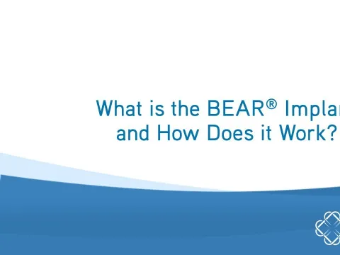 What is the BEAR Implant and How Does it Work? | Q&A | Dr. Sean Keyes | Miach Orthopaedics