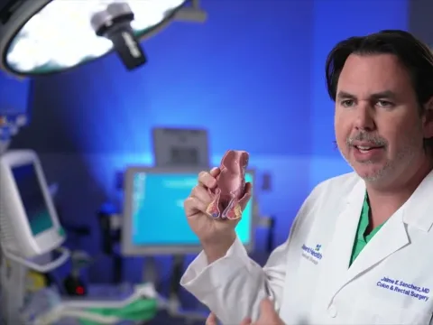 What to do when you get a hemorrhoid? Answered by Dr. Jaime Sanchez