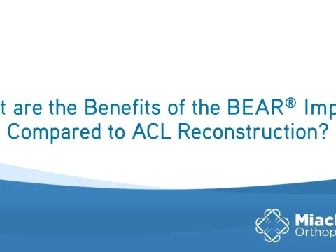 What are the Benefits of BEAR Implant Compared to ACLR? | Q&A | Dr. Sean Keyes | Miach Orthopaedics
