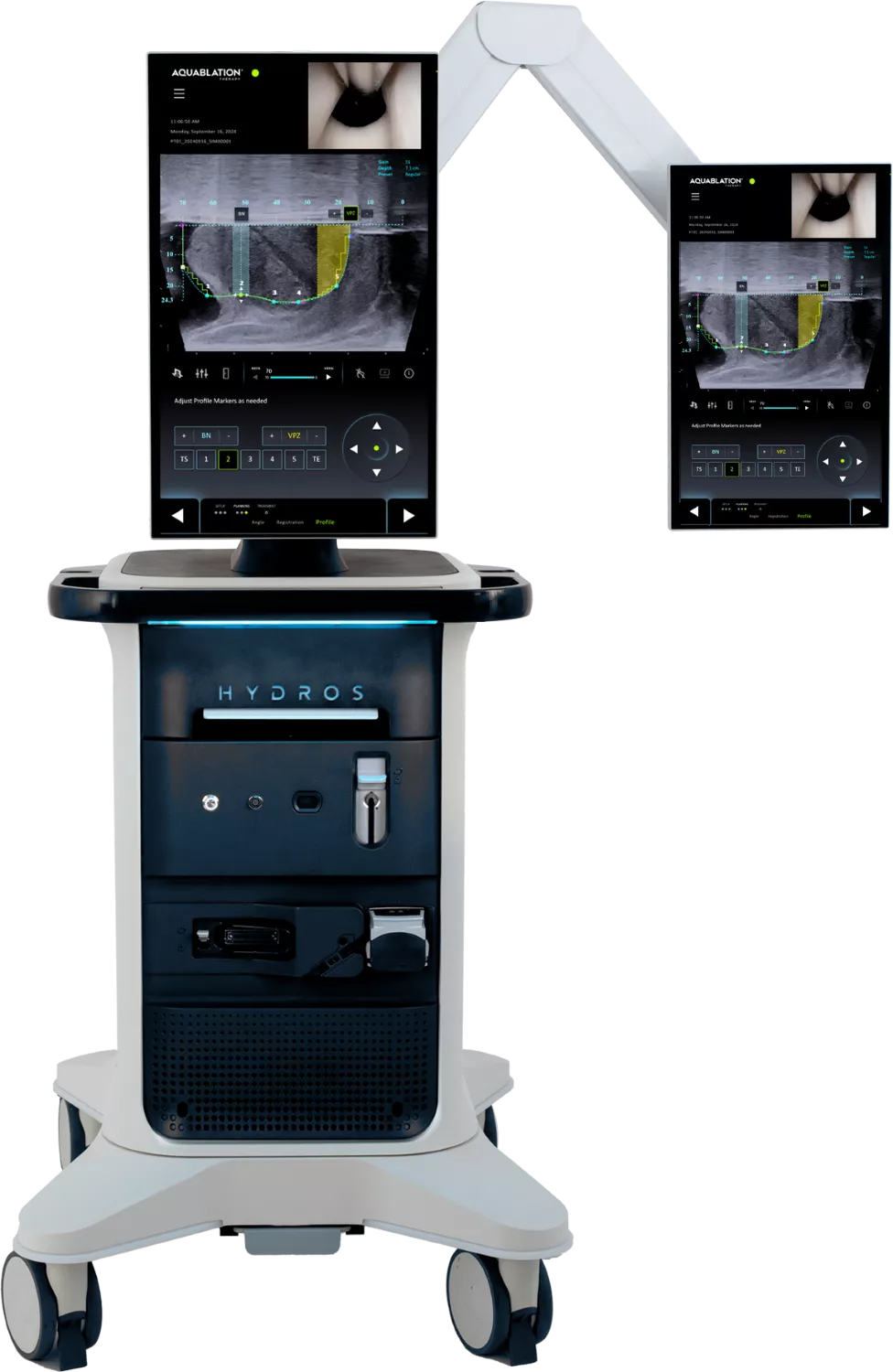 The Aquablation therapy is delivered through an AI-powered robotic system, which is clinically proven to provide significant, durable BPH symptom relief.
